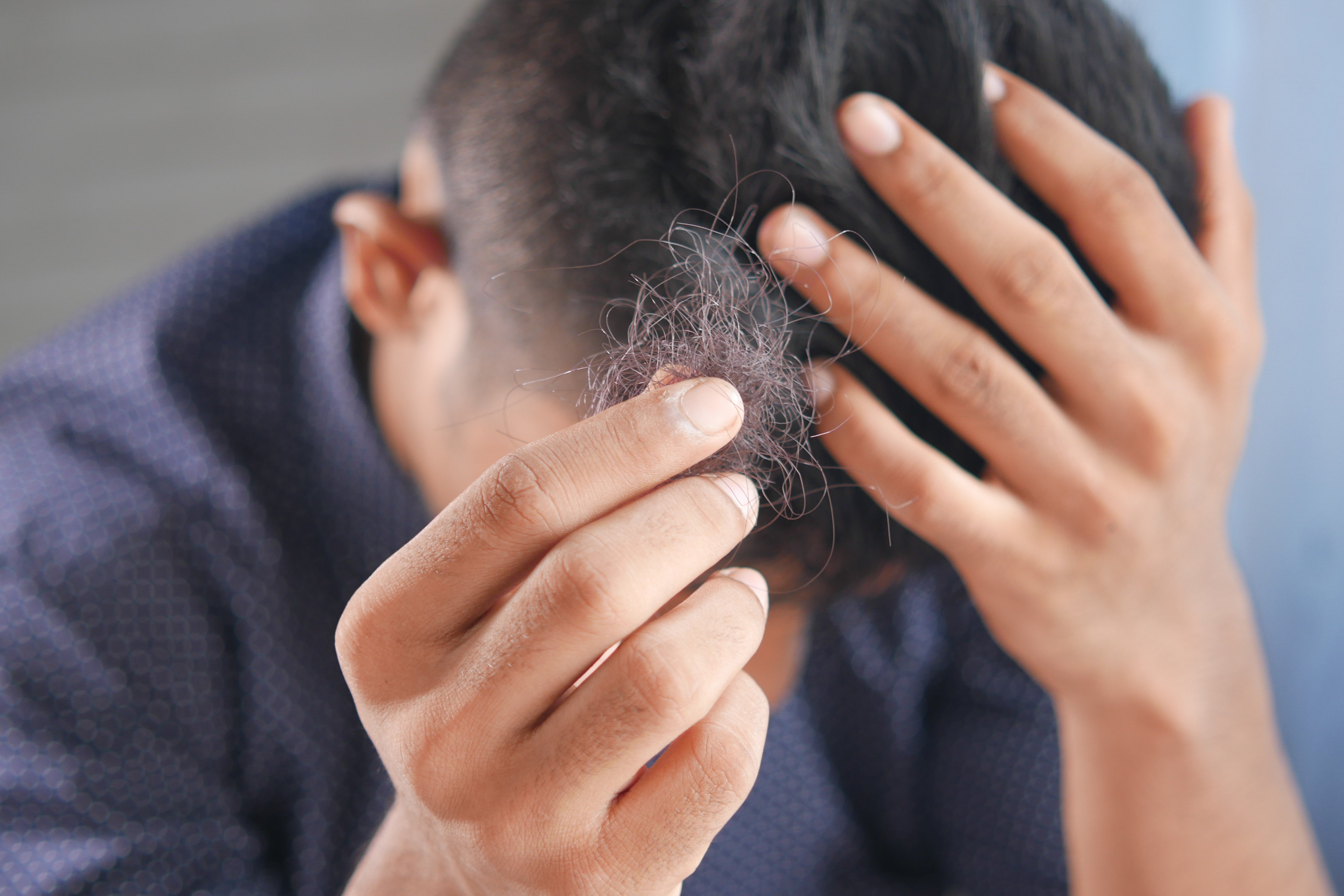 does cigarette cause hair fall Does Chewing Tobacco Cause Hair Loss? does cigarette cause hair fall Does Chewing Tobacco Cause Hair Loss?